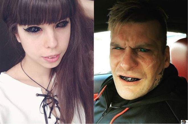 Jovem fica cega depois de tatuar os olhos para se parecer com rapper