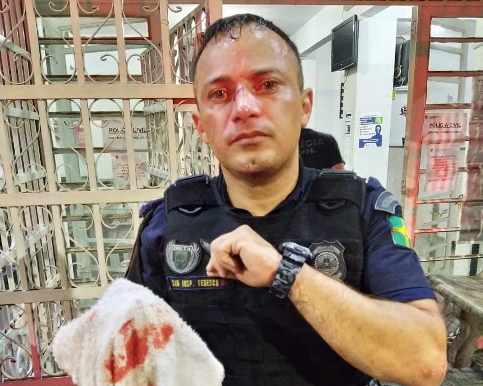 DESRESPEITO À QUARENTENA – Homem é ferido com tiro de bala de borracha e guarda civil tem nariz quebrado na Grande São Paulo