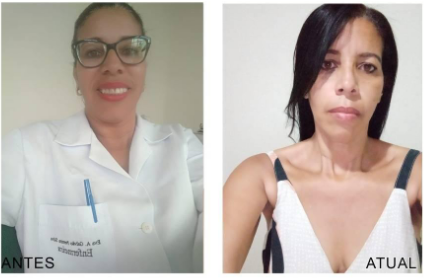 Veneciana com doença rara no esôfago pede ajuda para cirurgia urgente; saiba os detalhes