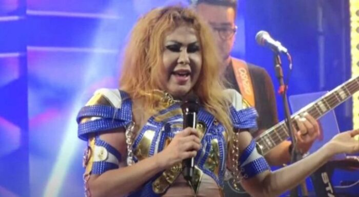 Joelma descobre doença que provocou inchaço no rosto; cantora dá pausa na carreira para cuidar da saúde